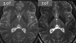 Illustration for article titled The World's Strongest MRI Will Be Able to Pick Up a Tank